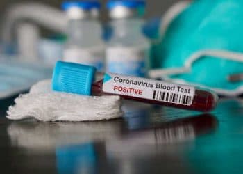 Tunisie : Mise au point des cas infectés par le virus Corona