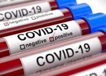 Tunisie-COVID-19 : un bilan de 864 cas confirmés et 37 décès