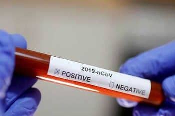 France-Coronavirus : 605 nouveaux décès dans les hôpitaux, 8911 morts au total en comptant les Ehpad