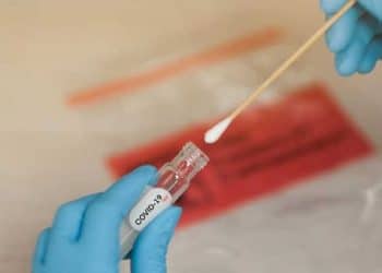 Coronavirus-Afrique :  Les pays africains ont réalisé plus de 28,3 millions de tests de dépistage du nouveau coronavirus