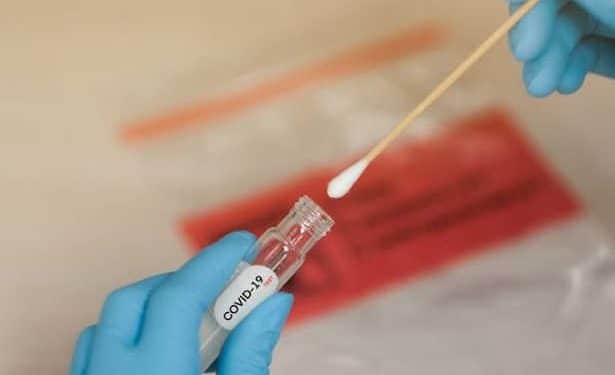 Coronavirus-Afrique : Les pays africains ont réalisé plus de 28,3 millions de tests de dépistage du nouveau coronavirus
