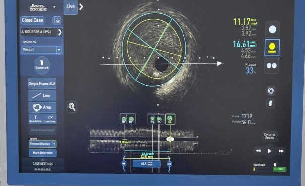 Innovation médicale : première implantation en Afrique d’un stent biodégradable à La Rabta