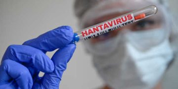 Hantavirus : un foyer international sur un navire, des cas confirmés en Europe et des inquiétudes sur la gestion des protocoles